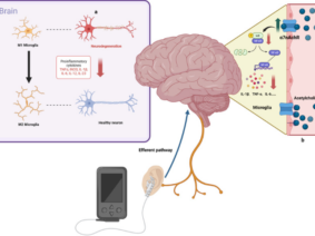 New strategy for Alzheimer’s disease intervention through the brain-gut-microbiota axis